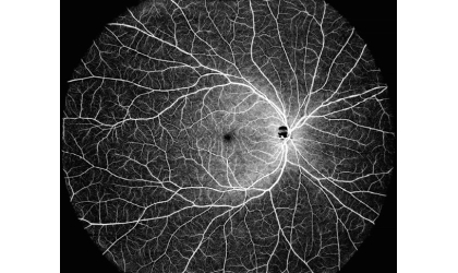 Intalight's Advanced Dream Oct Swept Source Imaging Technology får CE Mark